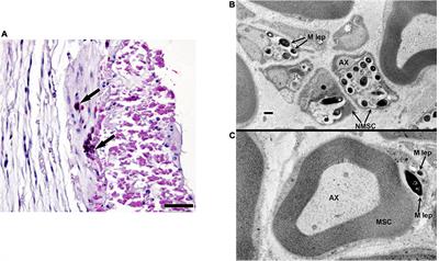 The Armadillo as a Model for Leprosy <mark class="highlighted">Nerve Function</mark> Impairment: Preventative and Therapeutic Interventions
